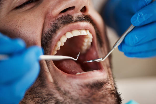 Best Emergency Dentist for Knocked-Out Tooth in Frisco City, AL