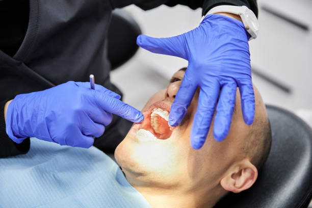 Best Broken or Cracked Tooth Emergency Dentist in Frisco City, AL