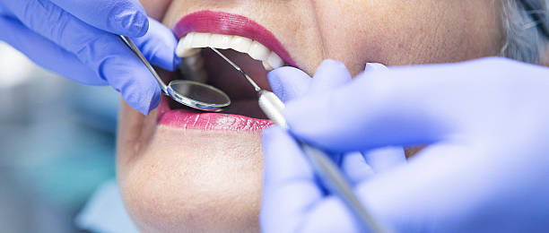 Best Emergency Dentist for Lost Fillings or Crowns in Frisco City, AL