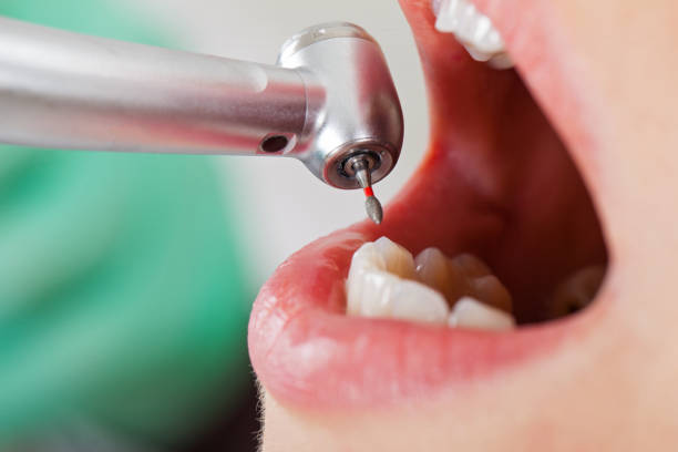 Best Emergency Dental Care for Abscessed Tooth in Frisco City, AL